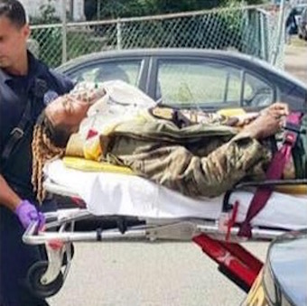 Fetty Wap Motorcycle Accident 4