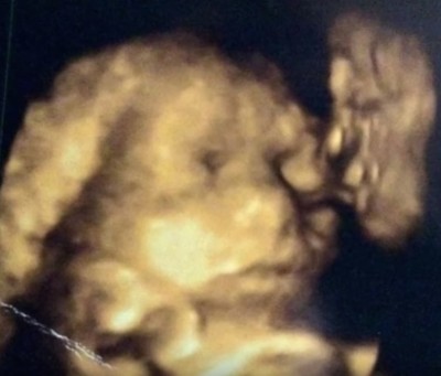 Jade Hornsby sonogram baby grandfather