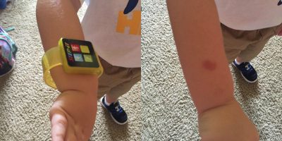 activity Trackers happy meal problem