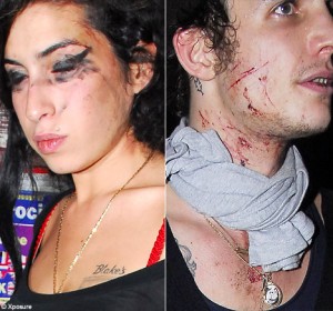 amyblake2308 468x438 300x280 Amy Winehouse: MARRIAGE OVER