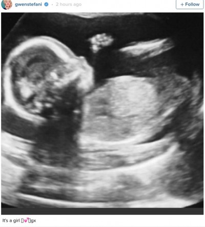 gwen Stefani ultrasound pregnant