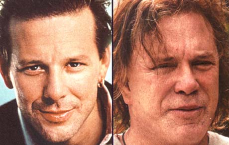 mickey rourke before plastic surgery
