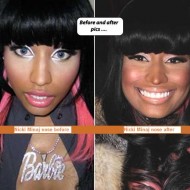 Nicki Minaj Before The Clown Makeup nicki minaj booty before and after 8 190x190 Nicki Minaj Before The Clown Makeup