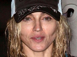  Meme on Nm Madonna Old 090224 Mn Madonna Totally Had Plastic Surgery