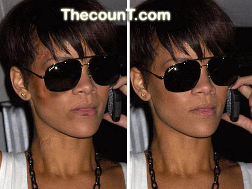 rihanna beat up pictures