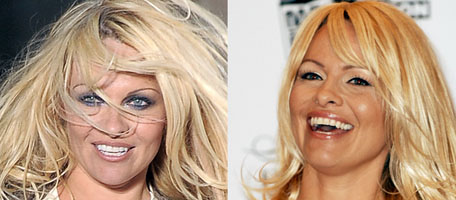  Pam Anderson Has Major Recent Plastic Surgery