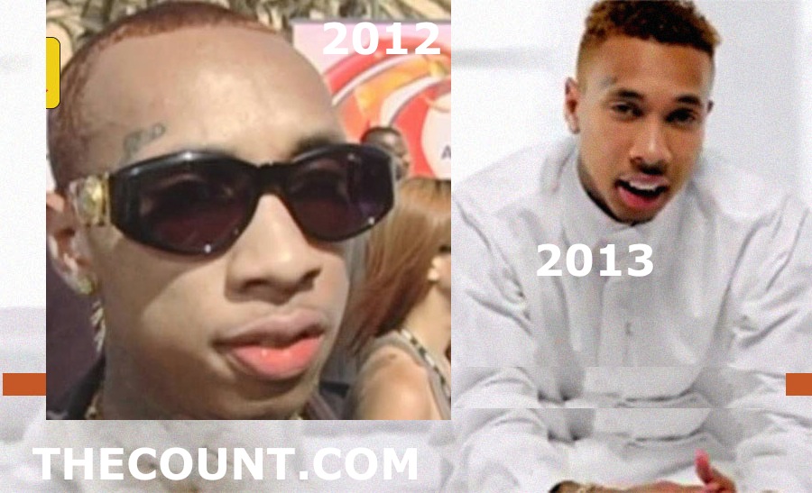 Is Rapper Tyga Wearing Hair Support In His New Video Thecount Com