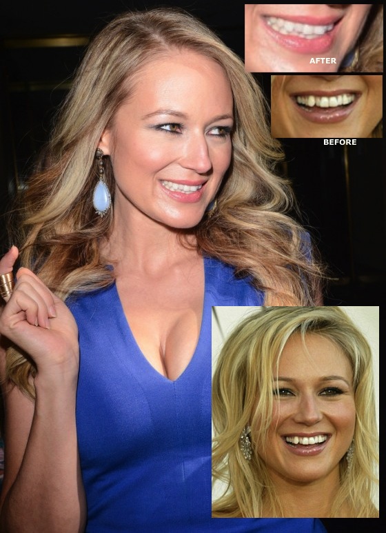 Jewel---Today-Show-in-New-York--02-560x820