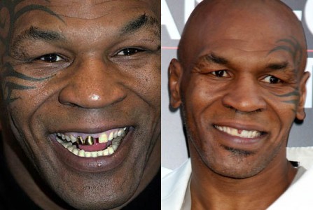 MIKE TYSON teeth – TheCount.com