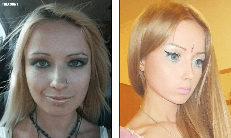 Human Barbie Valeria Lukyonova Before And After Nose Job