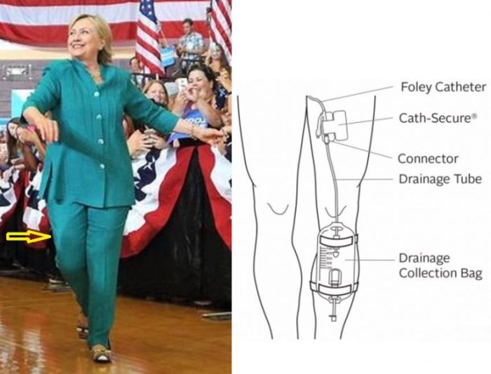 hillary clinton Foley catheter meme