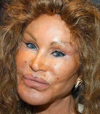 jocelyn-wildenstein-now