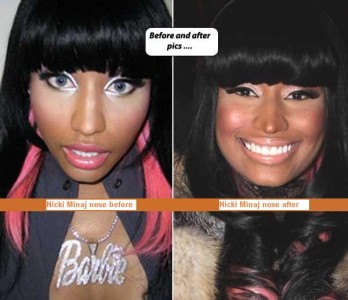 nicki_minaj_booty_before_and_after_8 – TheCount.com