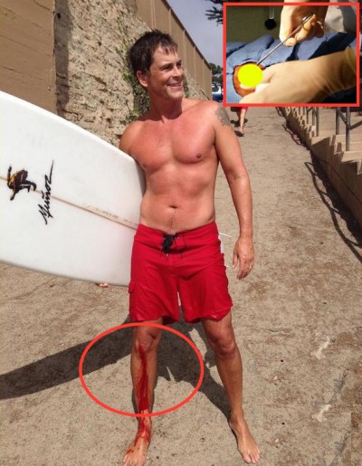rob-lowe-hurts-himself-while-surfing-still-looks-incredibly-hot-posing-shirtless-02