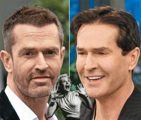 rupert everett new face The Hills Are Alive With Plastic Surgery. 